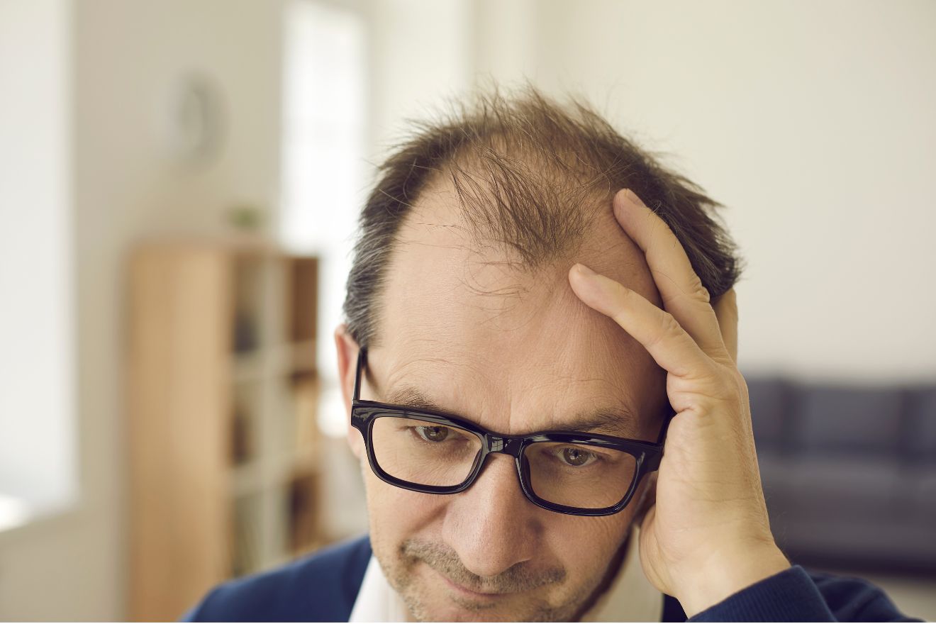 Man with thinning hair